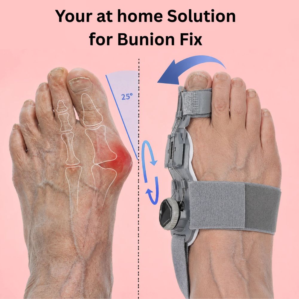 Curemed Bunion Fix